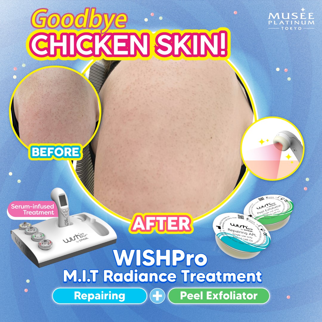 Wishpro MIT Radiance Treatment