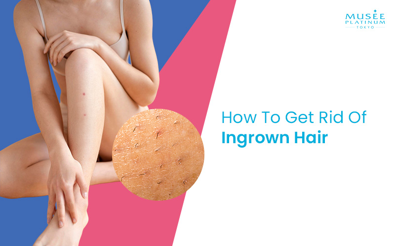 woman-skin-with-magnified-ingrown-hairs