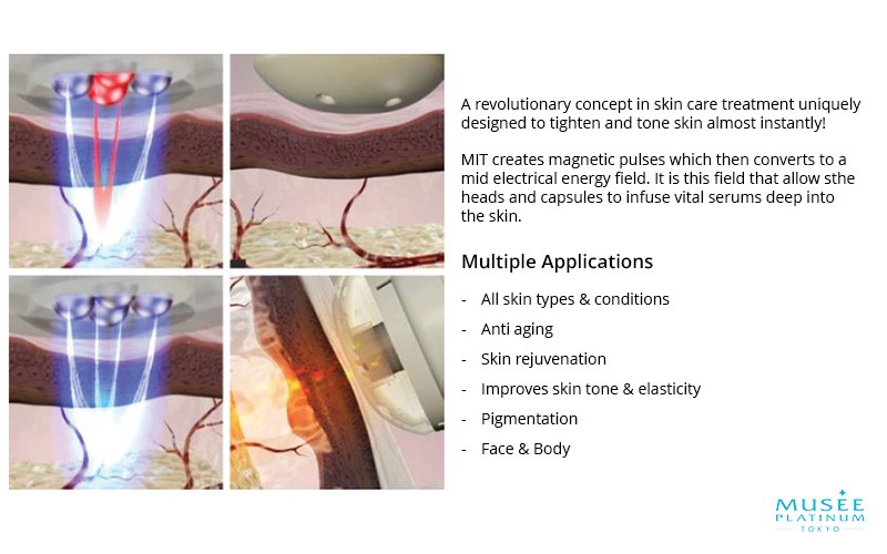 Applications of M.I.T Treatment - Wishpro